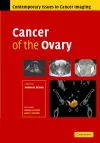 Cancer of the Ovary cover