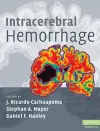 Intracerebral Hemorrhage cover