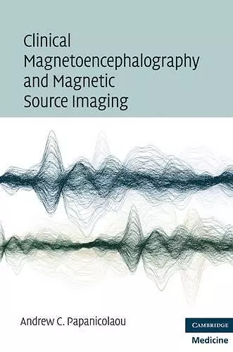 Clinical Magnetoencephalography and Magnetic Source Imaging cover