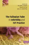 The Fallopian Tube in Infertility and IVF Practice cover