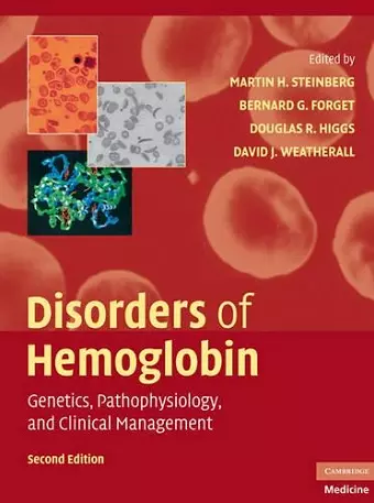 Disorders of Hemoglobin cover