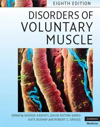 Disorders of Voluntary Muscle cover