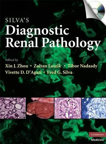 Silva's Diagnostic Renal Pathology cover