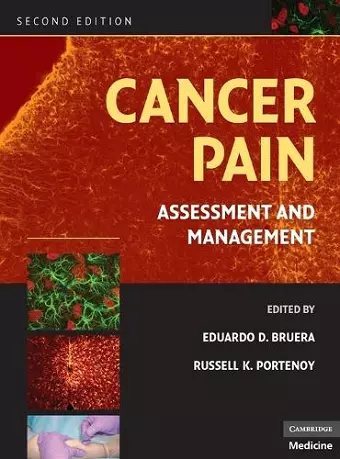 Cancer Pain cover