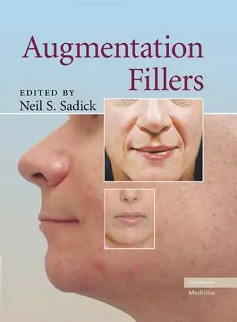 Augmentation Fillers cover