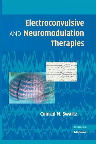 Electroconvulsive and Neuromodulation Therapies cover