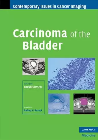 Carcinoma of the Bladder cover