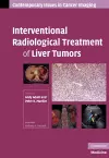 Interventional Radiological Treatment of Liver Tumors cover