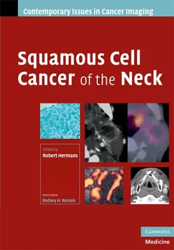 Squamous Cell Cancer of the Neck cover