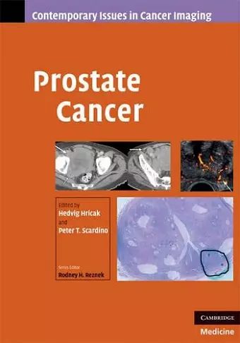 Prostate Cancer cover