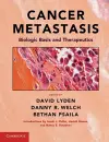 Cancer Metastasis cover