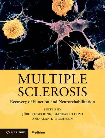 Multiple Sclerosis cover