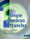 Single Embryo Transfer cover