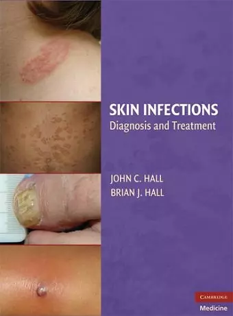 Skin Infections cover