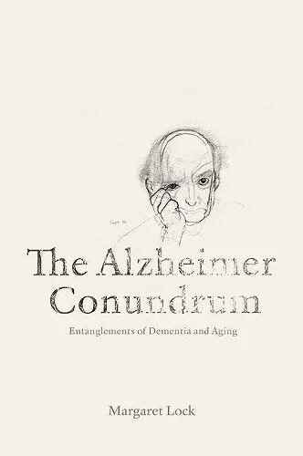 The Alzheimer Conundrum cover