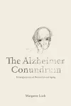 The Alzheimer Conundrum cover