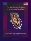 Carotid Artery Surgery cover