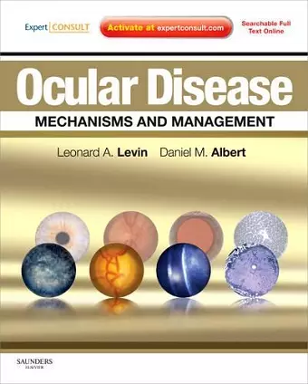 Ocular Disease: Mechanisms and Management cover