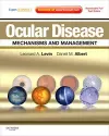 Ocular Disease: Mechanisms and Management cover