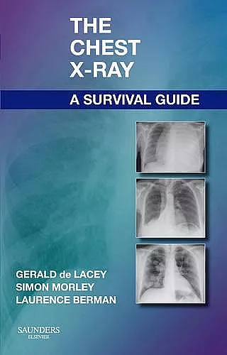 The Chest X-Ray: A Survival Guide cover