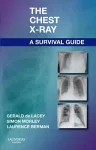 The Chest X-Ray: A Survival Guide cover