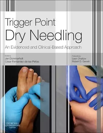 Trigger Point Dry Needling cover