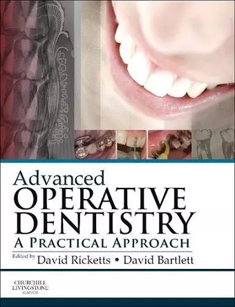 Advanced Operative Dentistry cover