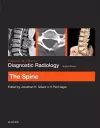 Grainger & Allison's Diagnostic Radiology: The Spine cover