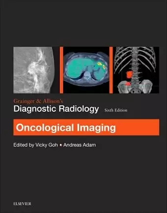 Grainger & Allison's Diagnostic Radiology: Oncological Imaging cover