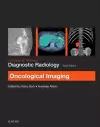 Grainger & Allison's Diagnostic Radiology: Oncological Imaging cover