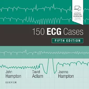 150 ECG Cases cover