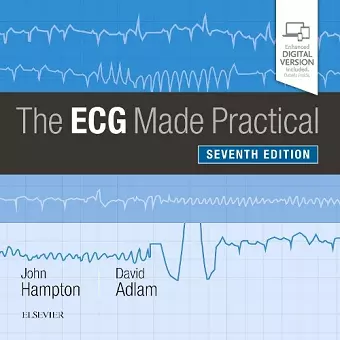 The ECG Made Practical cover