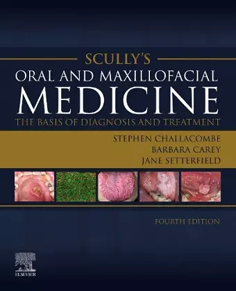 Scully's Oral and Maxillofacial Medicine: The Basis of Diagnosis and Treatment cover