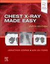 Chest X-Ray Made Easy cover