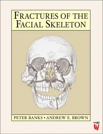 Fractures of the Facial Skeleton cover
