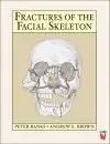 Fractures of the Facial Skeleton cover