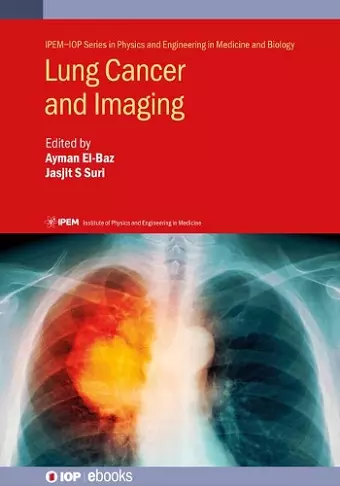 Lung Cancer and Imaging cover