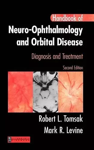 Handbook of Neuro-Ophthalmology cover