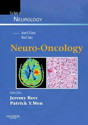 Neuro-Oncology cover