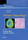 Neuro-Oncology cover