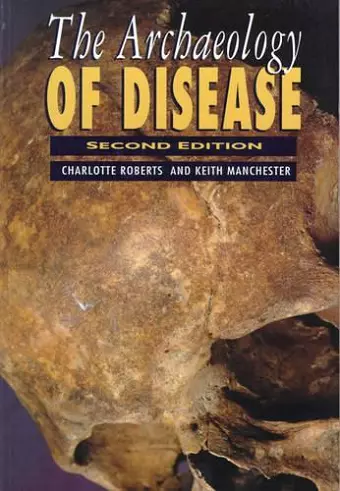 The Archaeology of Disease cover