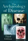The Archaeology of Disease cover