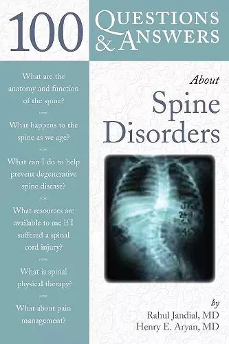 100 Questions  &  Answers About Spine Disorders cover