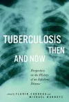 Tuberculosis Then and Now cover