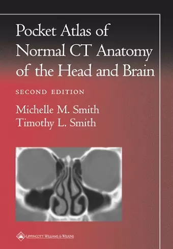 Pocket Atlas of Normal CT Anatomy of the Head and Brain cover