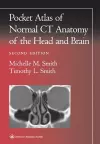 Pocket Atlas of Normal CT Anatomy of the Head and Brain cover