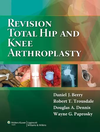 Revision Total Hip and Knee Arthroplasty cover