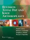 Revision Total Hip and Knee Arthroplasty cover