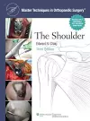 Master Techniques in Orthopaedic Surgery: Shoulder cover