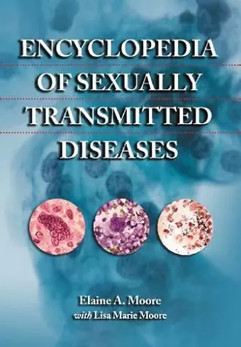 Encyclopedia of Sexually Transmitted Diseases cover